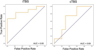 Predicting interindividual response to theta burst stimulation in the lower limb motor cortex using machine learning